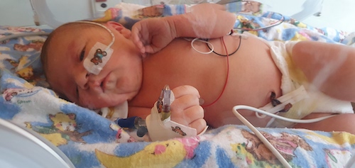 What You Need To Know About Group B Strep (GBS) neonatal